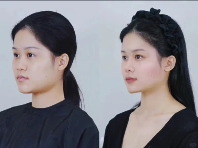00 后小美今日份 “返厂维修” 打卡!