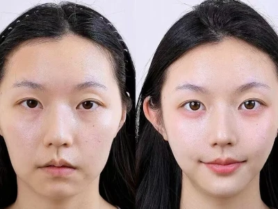 一键还原元气少女感