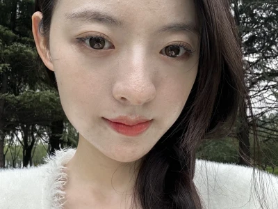 脂溢性皮炎室外原相机 最近很漂亮