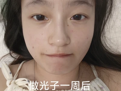 第二次光子前后对比图