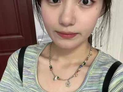 姑娘脸上的白癜风。彻底干净。