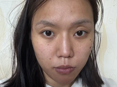 我的脸怎么才能美一点?