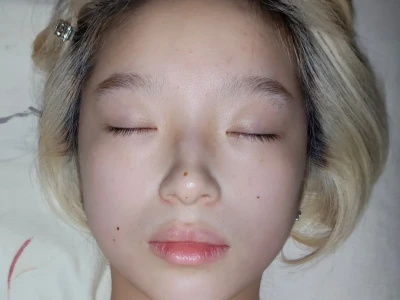 19岁熬了一个通宵的皮肤状态