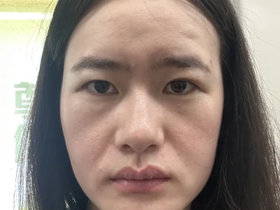 姐妹有没有好的建议我这脸要咋救啊