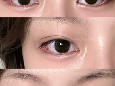来我眼里看星星✨