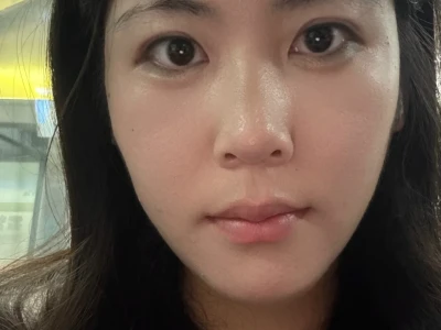 为什么我脸上的纹路这么明显