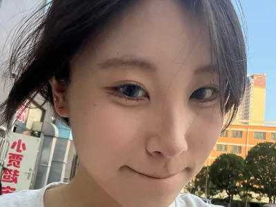 厦门瘦脸针一个月啦~每天都在偷乐😄