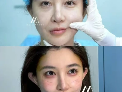 期待你面若桃花