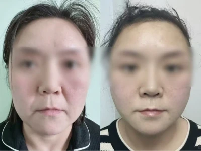 精致的医美脸,不是梦~