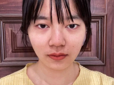 当 标准阔面脸打瘦脸针...