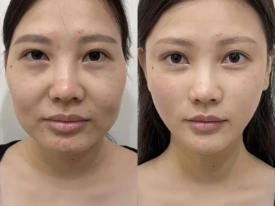 从40+大妈变成20+,只用这几步