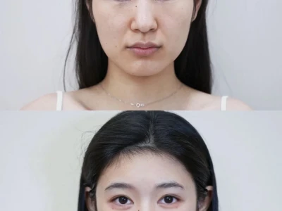 丑女变美女的来时路～