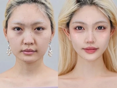 全脸微调后,姐的美貌到了下一个level~